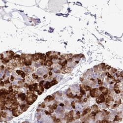 eIF5A Antibody, Novus Biologicals:Antibodies:Primary Antibodies
